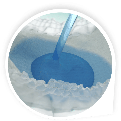 12 Hour Leak Protection
